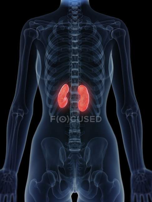 Ilustração dos rins inflamados na silhueta do corpo humano
. — Fotografia de Stock