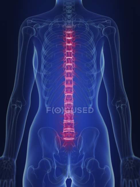 Ilustración de la silueta humana con espalda dolorida . - foto de stock