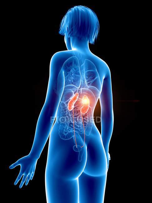 Ilustración de silueta femenina con riñón doloroso . - foto de stock