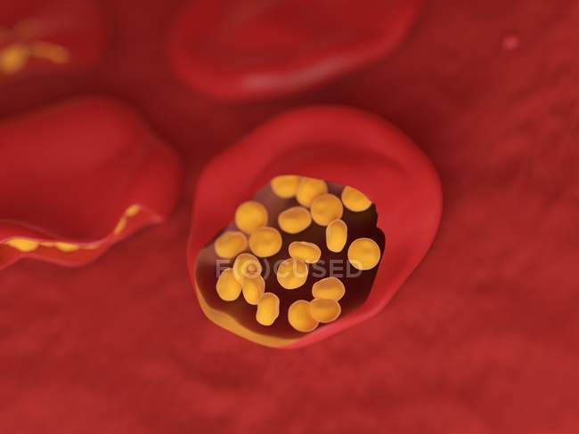 Illustrazione delle cellule ematiche infette da malaria . — Foto stock