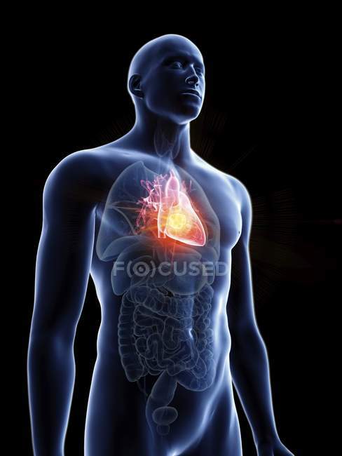 Ilustración de silueta azul transparente del cuerpo masculino con tumor cardíaco de color . - foto de stock