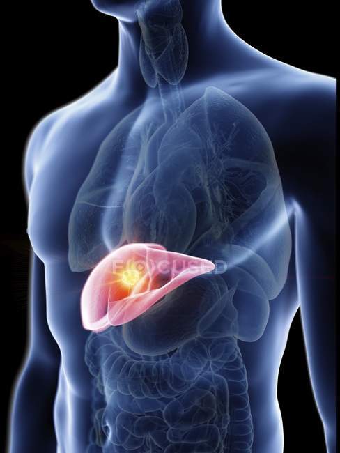 Illustrazione della silhouette blu trasparente del corpo maschile con tumore al fegato colorato . — Foto stock
