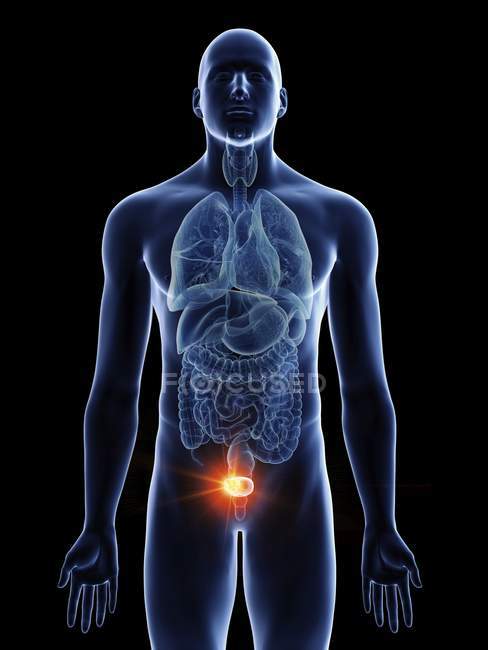 Illustration of bladder cancer in male body silhouette on black background. — Stock Photo