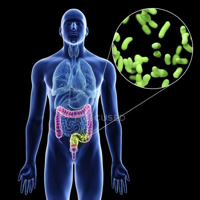 Ілюстрація колон інфекції бактерій в чоловічому організмі силует на чорному фоні. — стокове фото