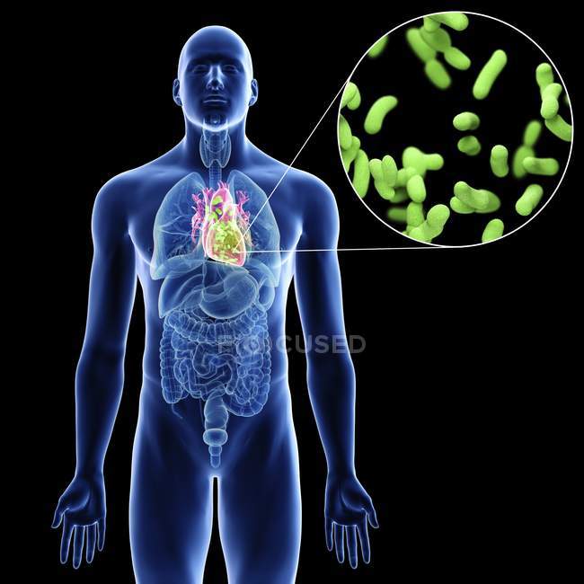 Ілюстрація серця та крупним планом інфекційних бактерій у силуеті чоловічого тіла на чорному тлі . — стокове фото