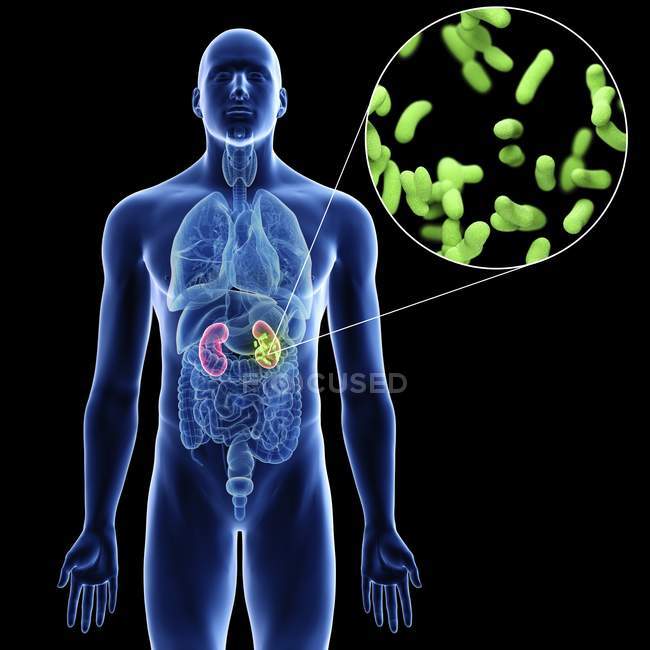 Illustration of kidneys and close-up of infection bacteria in male body silhouette on black background. — Stock Photo