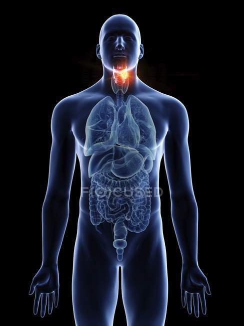 Ilustración de cáncer de laringe en silueta corporal masculina sobre fondo negro . - foto de stock