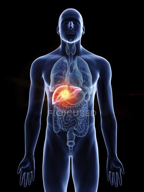 Ilustración de cáncer de hígado en silueta corporal masculina sobre fondo negro . - foto de stock