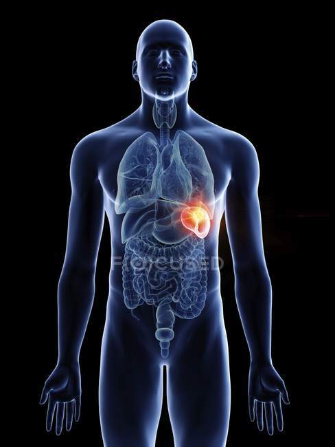 Illustration du cancer de la rate dans la silhouette du corps masculin sur fond noir . — Photo de stock
