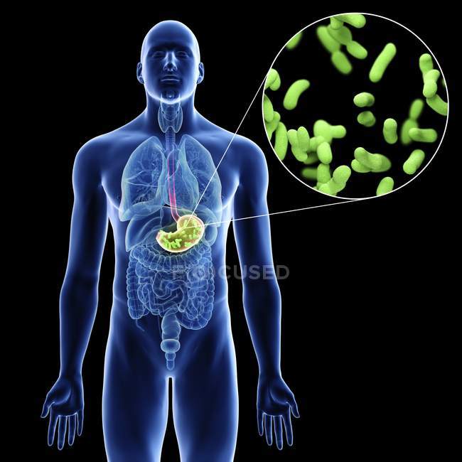 Illustration de l'estomac et gros plan des bactéries vertes d'infection dans la silhouette du corps masculin sur fond noir . — Photo de stock