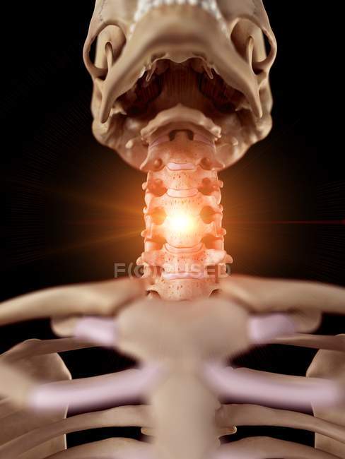 Ilustración del esqueleto humano cuello doloroso . - foto de stock