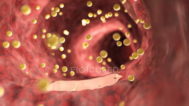 Illustration of gluten inside the colon. — Stock Photo