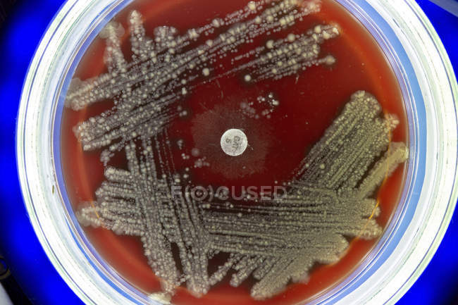 Placa de Petri com colônias de micróbios, close-up
. — Fotografia de Stock