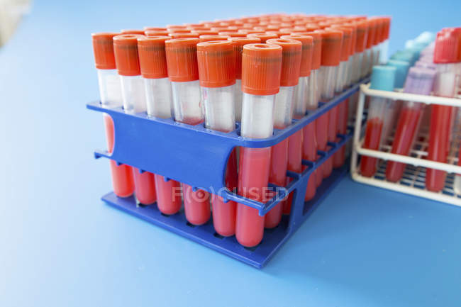Racks de tubos de ensaio com tampas vermelhas na mesa azul . — Fotografia de Stock