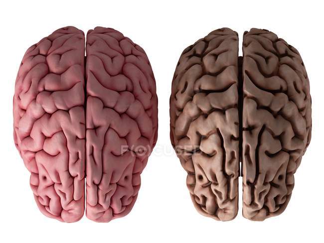 3d ilustración representada de cerebro sano e insalubre sobre fondo blanco
. - foto de stock