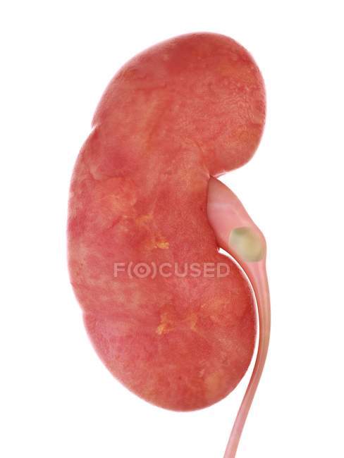 3d rendered illustration of kidney stone on white background. — Stock Photo