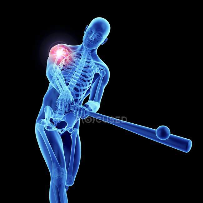3D gerenderte Illustration des männlichen Baseball-Athleten schmerzhafte Schulter. — Stockfoto