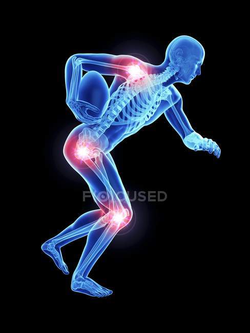3d renderizado ilustración de atleta masculino con bola y articulaciones dolorosas . - foto de stock