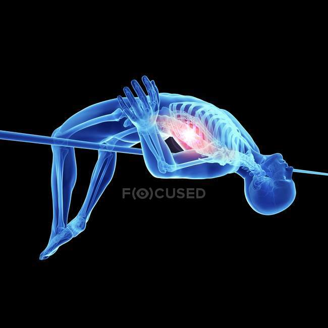 3D gerenderte Illustration des springenden männlichen Athleten schmerzhafte Wirbelsäule. — Stockfoto