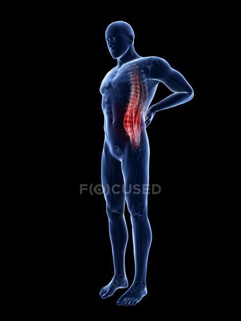 3d renderizado ilustración de silueta azul del hombre con dolor de espalda . - foto de stock