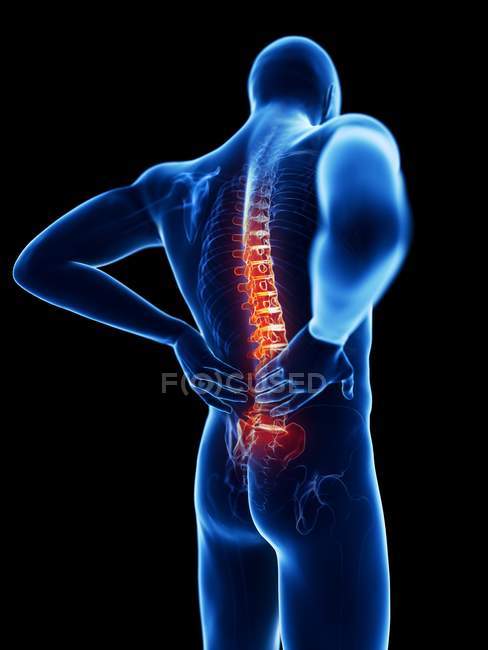 3D gerenderte Illustration der blauen Silhouette eines Mannes mit Rückenschmerzen. — Stockfoto