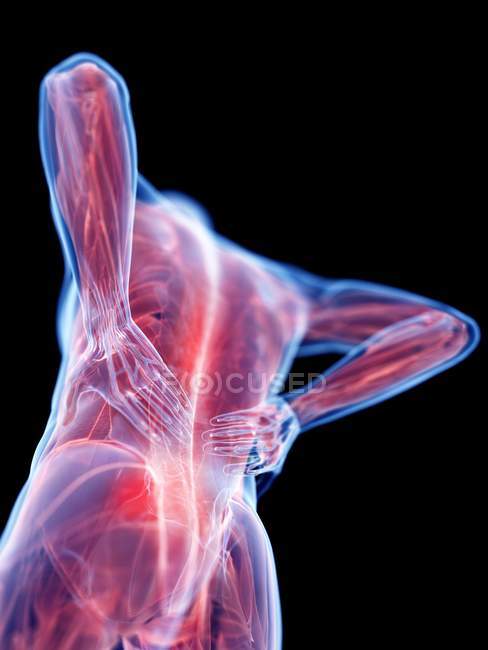 3D gerenderte Illustration der Silhouette eines Mannes mit Rückenschmerzen. — Stockfoto