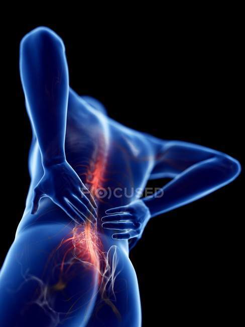 3d renderizado ilustración de silueta azul del hombre con dolor de espalda
. - foto de stock