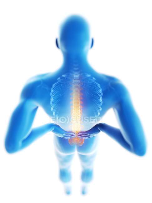 3d renderizado ilustración de silueta azul del hombre con dolor de espalda
. - foto de stock