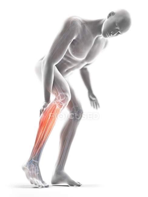 3d rendered illustration of grey silhouette of man with painful calf. — Stock Photo