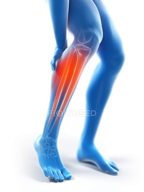 3d rendered illustration of blue silhouette of male legs with painful calf. — Stock Photo