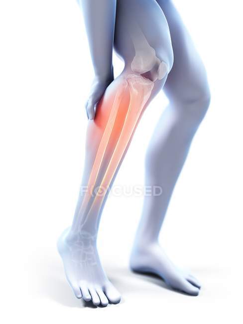 3d rendered illustration of grey silhouette of male legs with painful calf. — Stock Photo