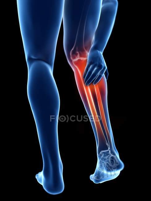 3D gerenderte Illustration der blauen Silhouette männlicher Beine mit schmerzhaftem Kalb auf schwarzem Hintergrund. — Stockfoto
