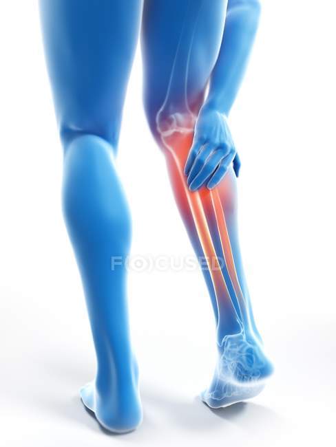 3D ілюстрація синього силуету чоловічих ніг з болючим телям на білому тлі . — стокове фото