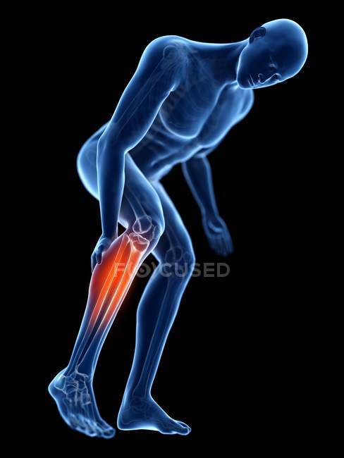 3d rendered illustration of blue silhouette of man with painful calf on black background. — Stock Photo