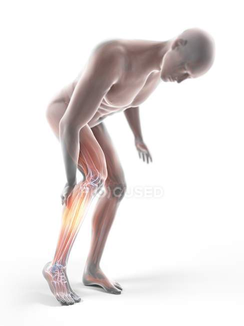 3d rendered illustration of grey silhouette of man with painful calf on white background. — Stock Photo