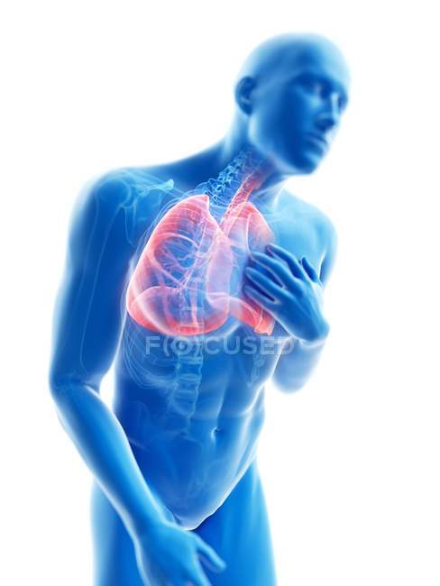 3D gerenderte Illustration der blauen Silhouette des Menschen mit entzündeten Lungen. — Stockfoto