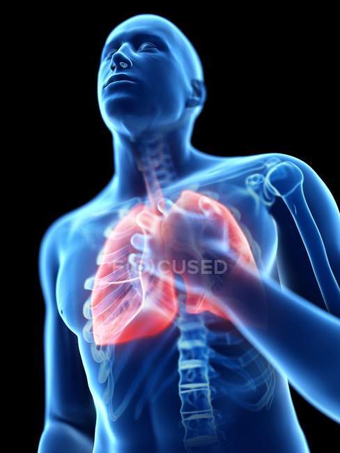 3D gerenderte Illustration der blauen Silhouette des Menschen mit entzündeten Lungen auf schwarzem Hintergrund. — Stockfoto