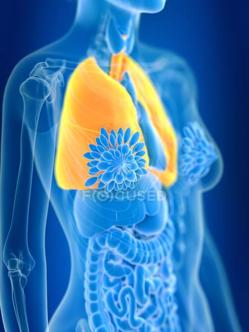 3d renderizado ilustración de los pulmones femeninos de color en silueta corporal . - foto de stock