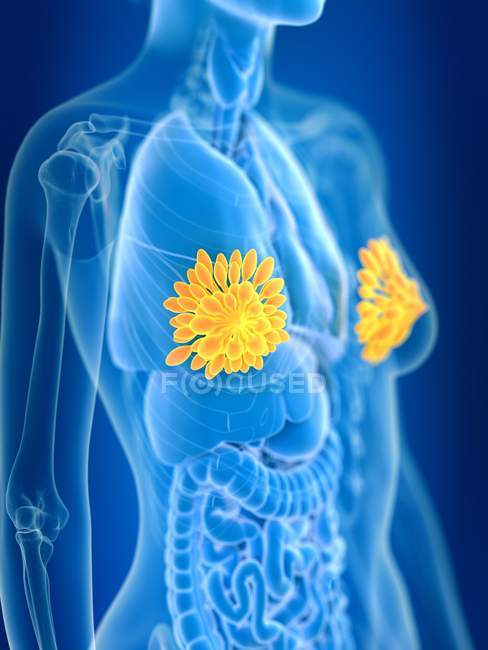 3d rendered illustration of colored female mammary glands in body silhouette. — Stock Photo