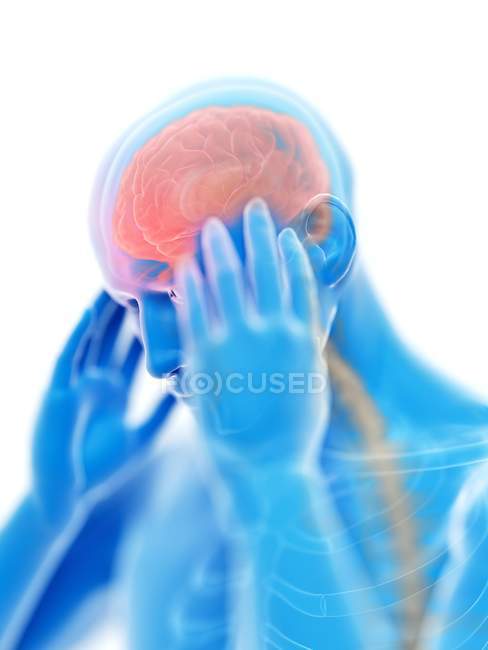 3D рендеринг иллюстрация синего силуэта человека с головной болью на белом фоне . — стоковое фото
