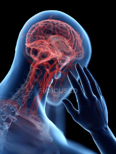 3D gerenderte Illustration der blauen Silhouette eines Mannes mit Kopfschmerzen auf schwarzem Hintergrund. — Stockfoto