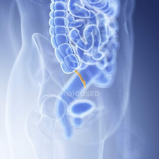 Illustrazione medica dell'appendice visibile nel corpo umano . — Foto stock