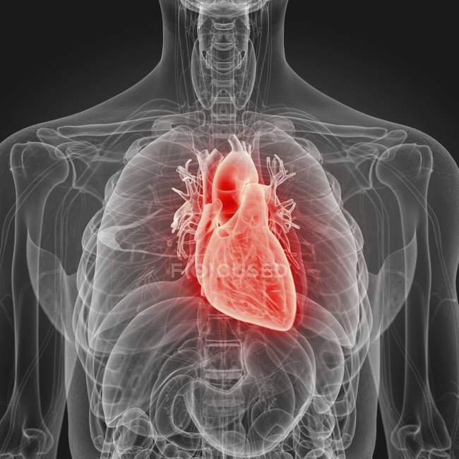 Ilustración del corazón inflamado en la silueta del cuerpo humano . - foto de stock