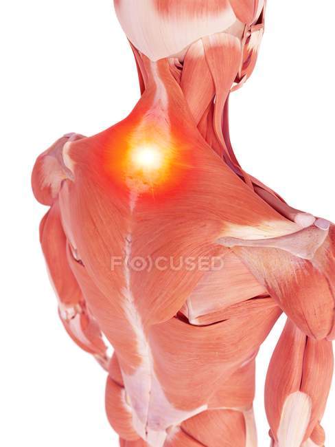 Illustration de douleurs musculaires dorsales dans le corps humain . — Photo de stock