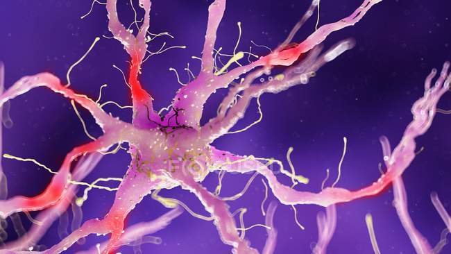 Ілюстрація пошкодженої нервової клітини на фіолетовому фоні . — стокове фото