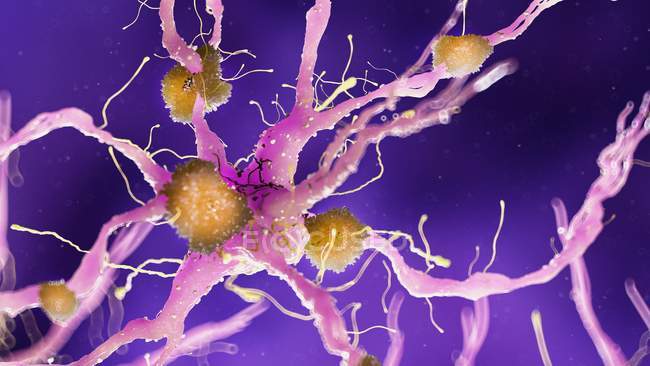 Illustration colorée des plaques amyloïdes sur les cellules nerveuses . — Photo de stock