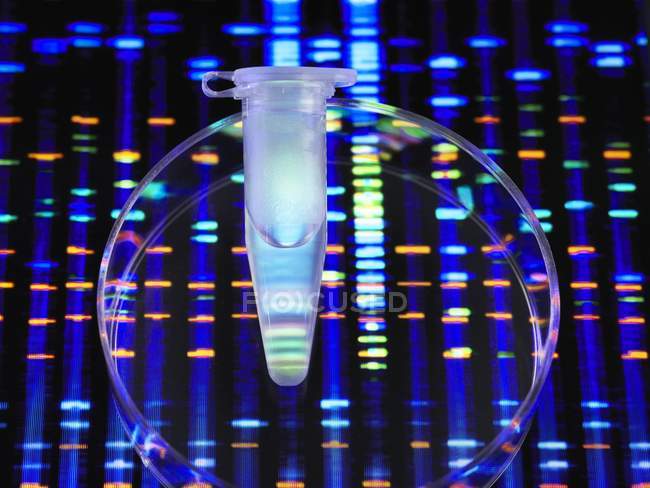 Genetische Forschungsröhre mit DNA-Probe und DNA-Profil im Hintergrund. — Stockfoto