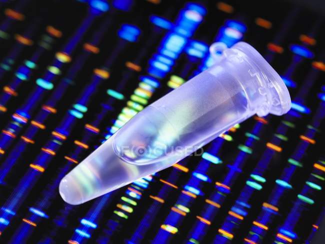 Genetische Forschungsröhre mit DNA-Probe und DNA-Profil im Hintergrund. — Stockfoto