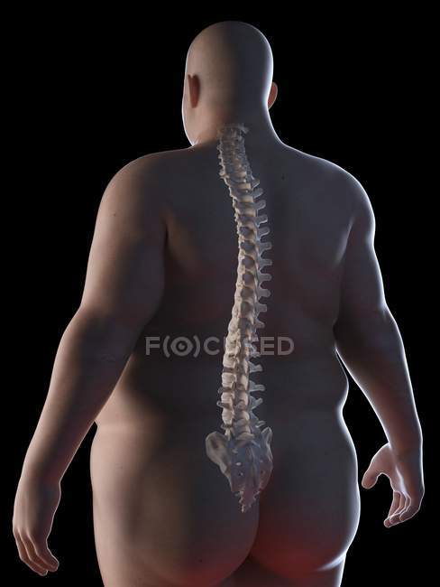 Ілюстрація силуету ожиріння людини з видимим хребтом . — стокове фото