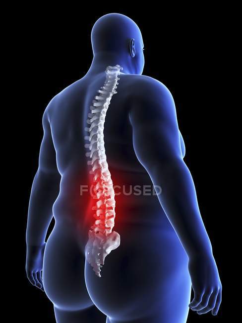 Ilustração da silhueta do homem obeso com dor nas costas
. — Fotografia de Stock